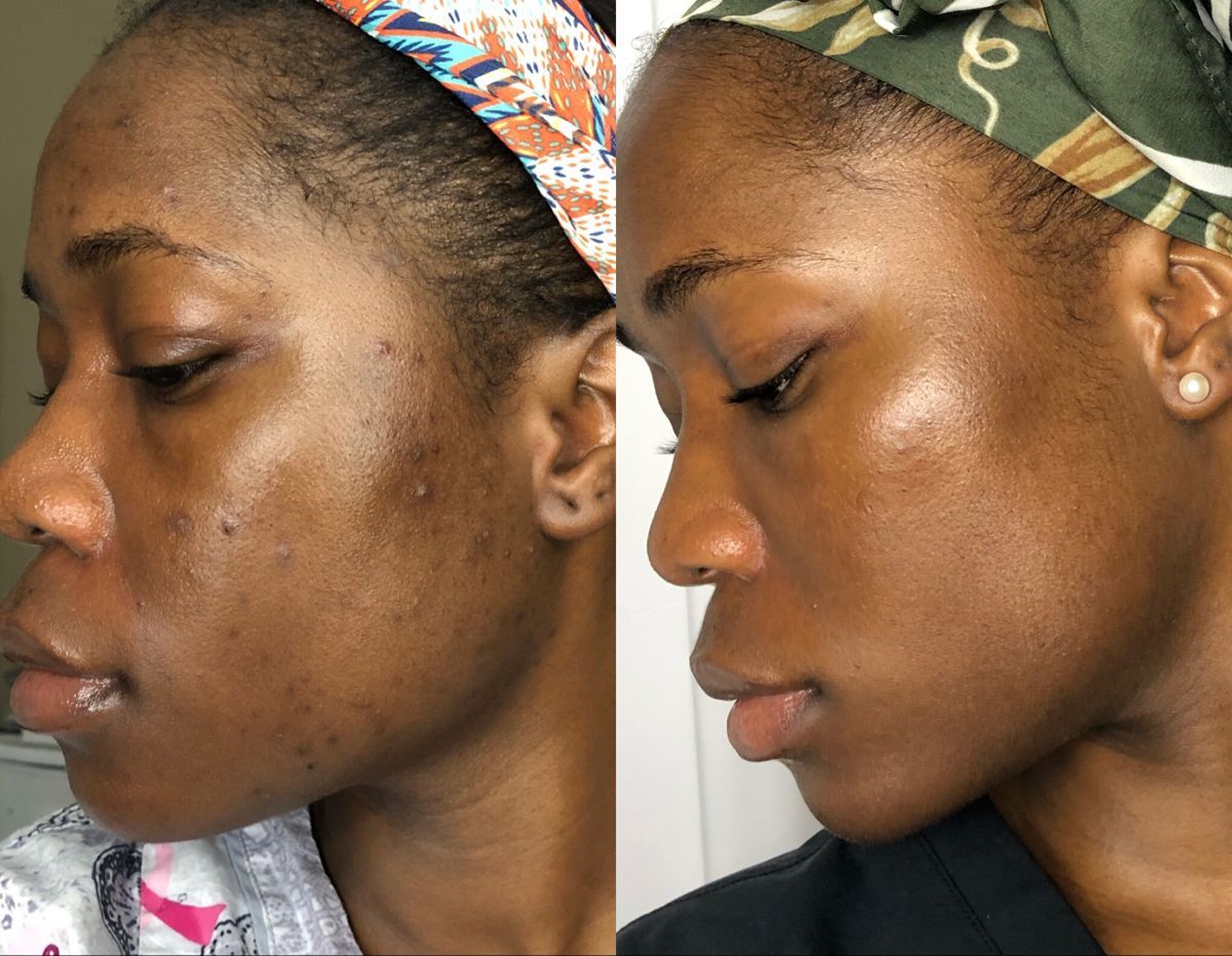 customer photo