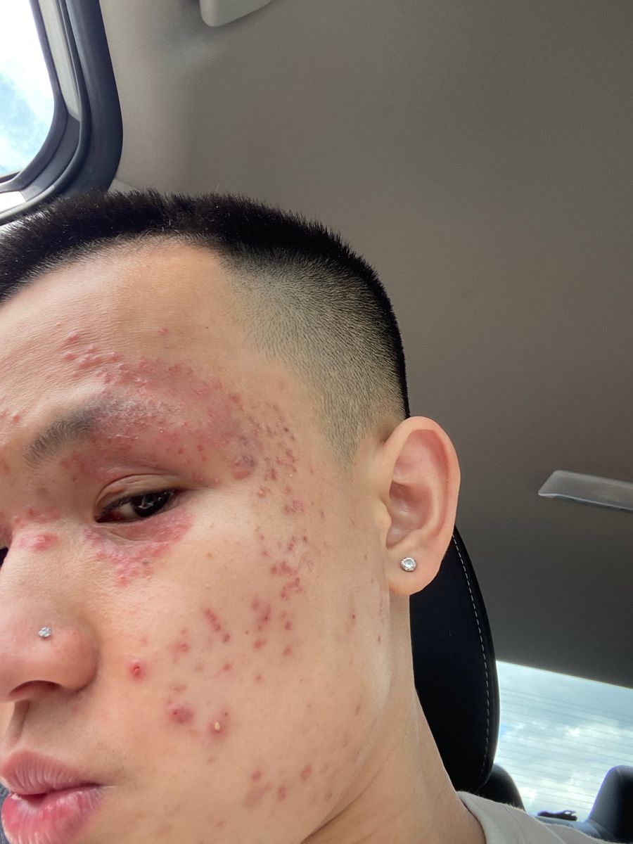 customer photo before