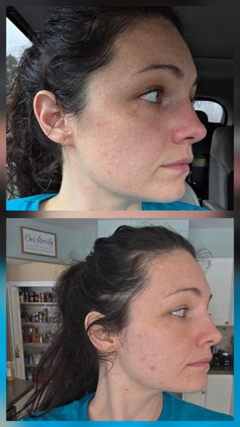 Two side-by-side profile photos of a woman with dark hair pulled back, showing a before and after comparison in different indoor settings.