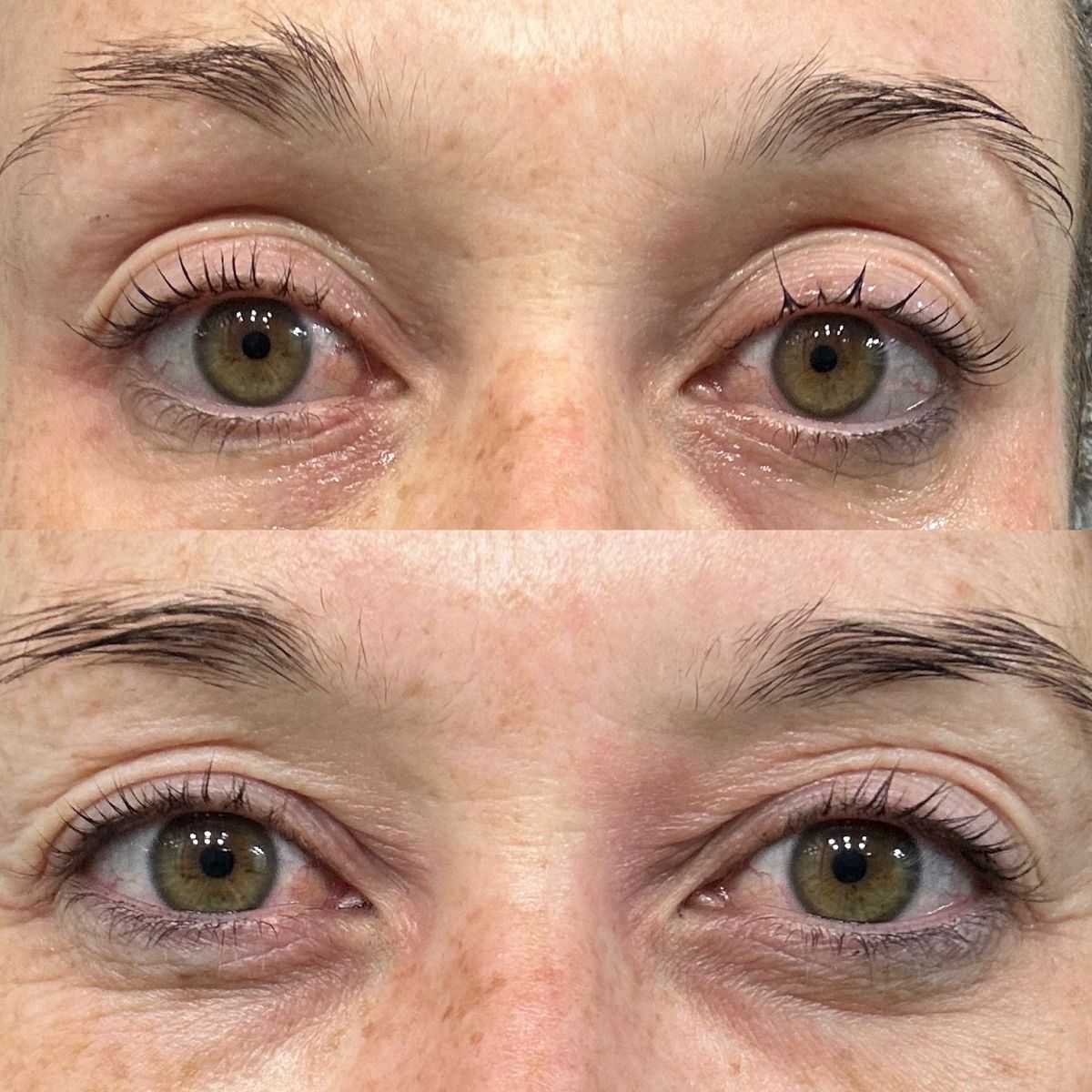 SBLA Eye Lift Wand customer photo