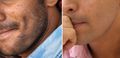 Two close-up side profile images showing intimate physical contact between two people.