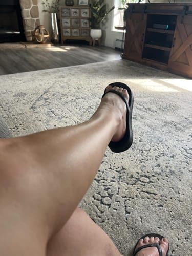 Customer photo: Shirley B.’s legs after two weeks