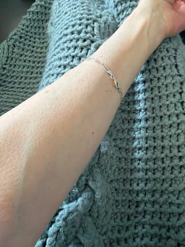 Customer photo: Maryann P.’s forearm