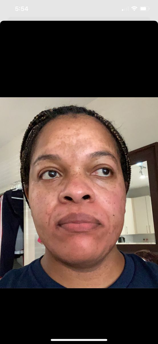 After - Karen S.