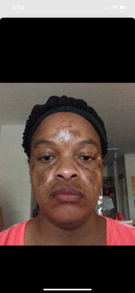 Before - Karen S.