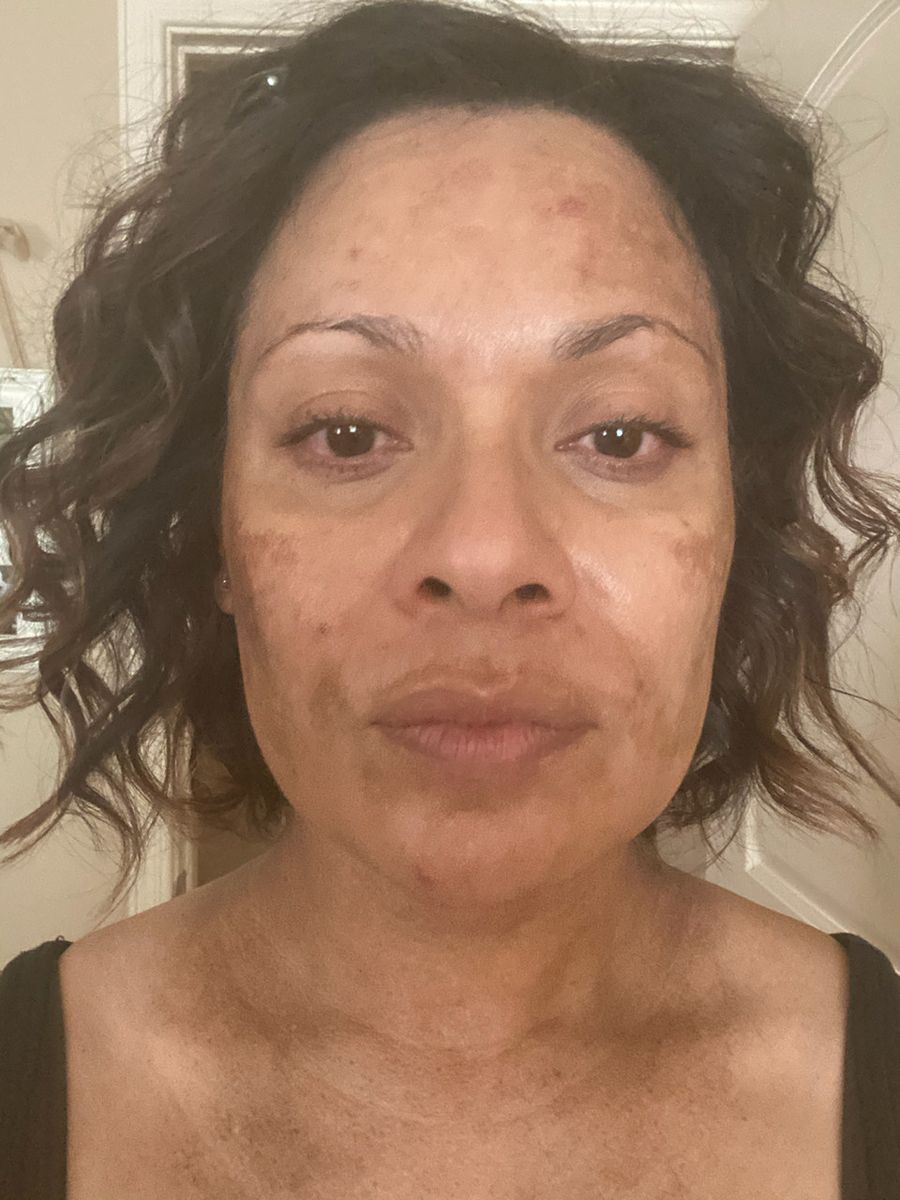 Before - Michelle T.