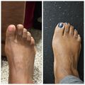 Before and after comparison of a foot showing toenails without polish on the left and with dark blue nail polish on the right