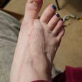 A person's hand and wrist showing visible veins beneath the skin, with blue nail polish on three fingernails