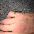 Square Ring