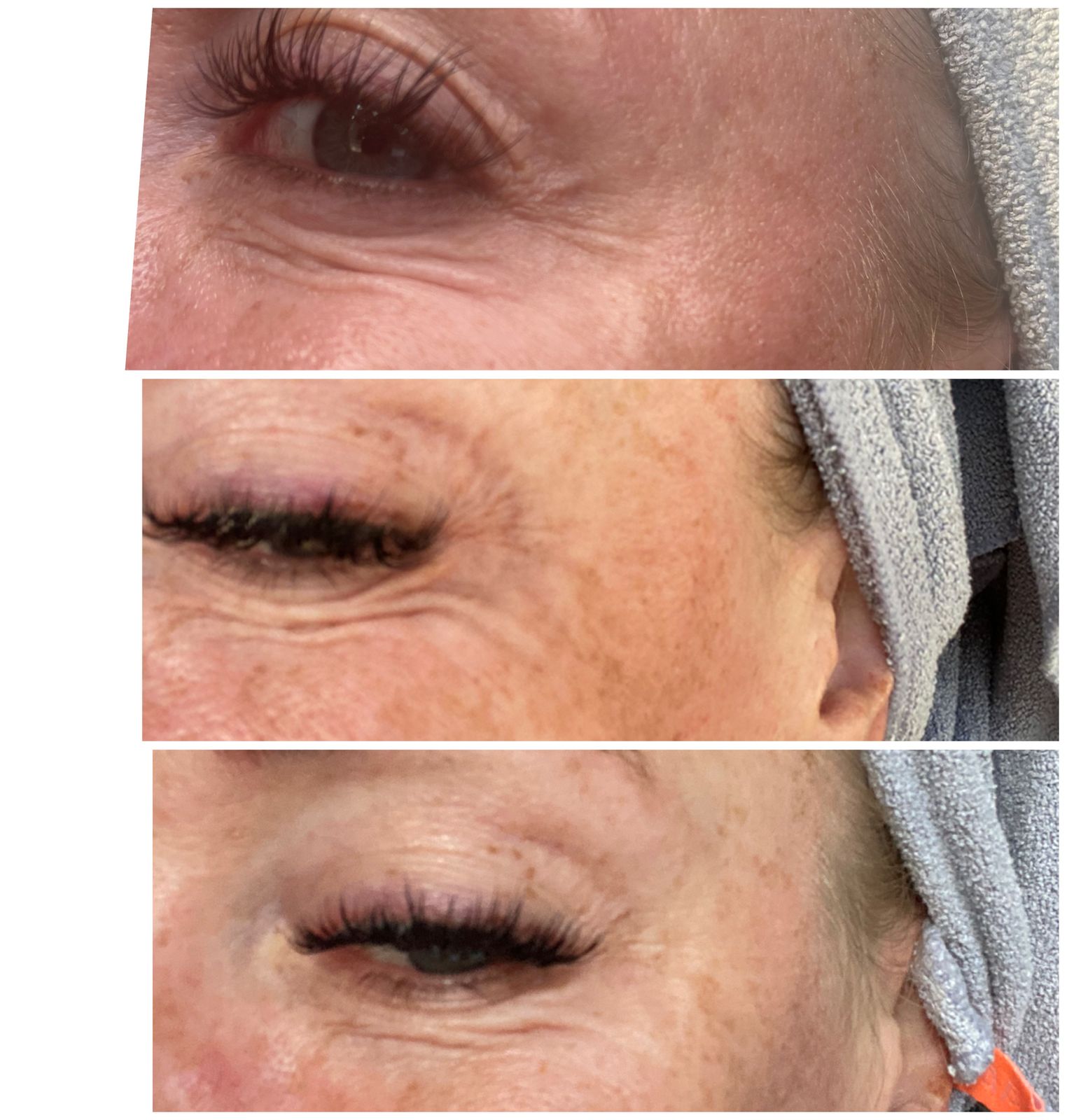 LED Eye Mask | Under Eye Red Light Therapy | CurrentBody Canada