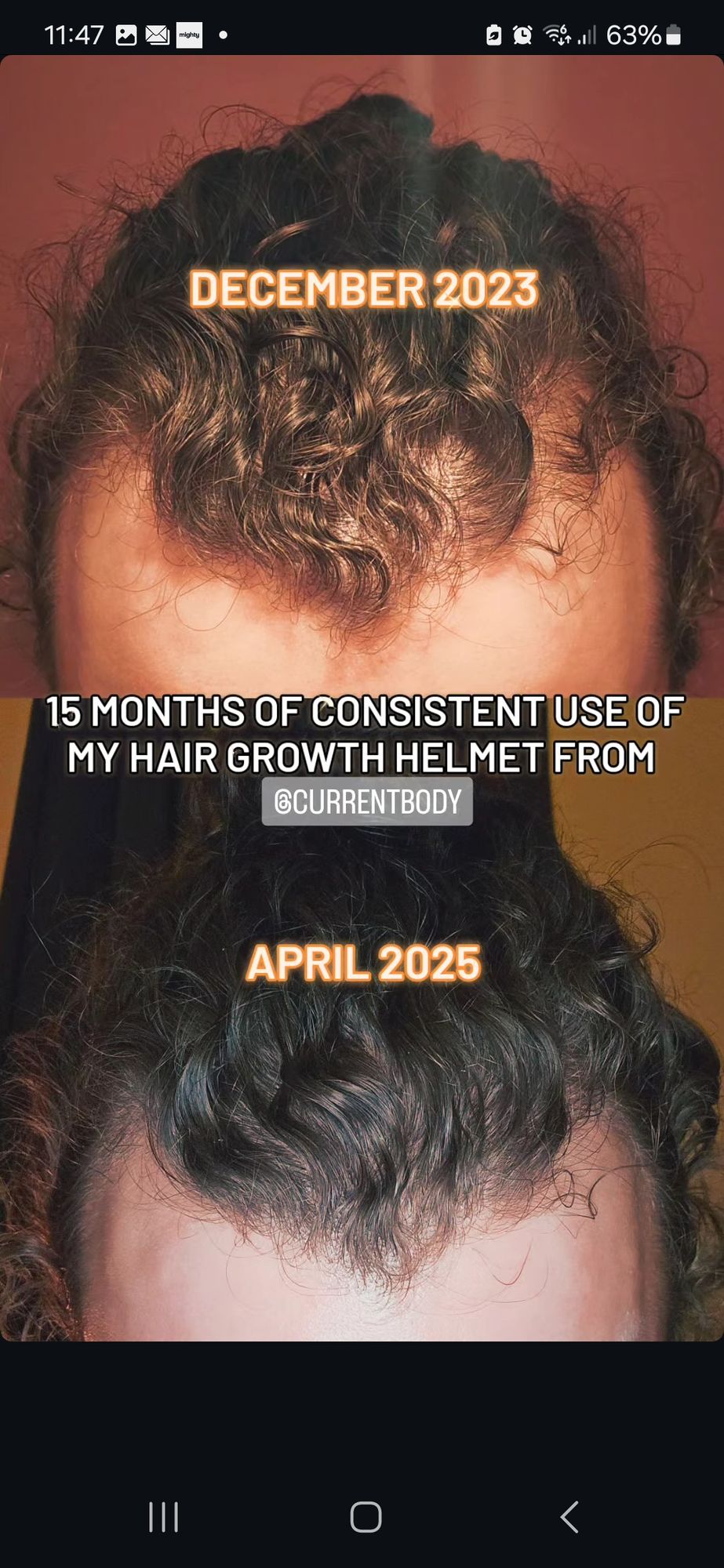 Red Light Therapy for Hair Loss LED Hair Growth Helmet