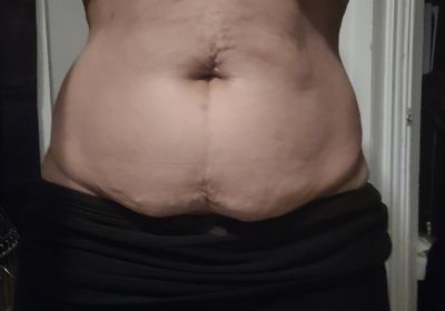 Customer-uploaded image. Click to see more details. The image represents: Person's midsection showing abdomen area