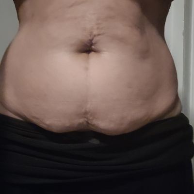 Customer-uploaded image. Click to see more details. The image represents: Person's midsection showing abdomen area