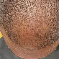 Customer-uploaded image. Click to see more details. The image represents: Close-up view of the back of a person's head showing hair texture and scalp