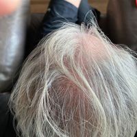 Customer-uploaded image. Click to see more details. The image represents: Person with gray hair lying back in what appears to be a salon chair