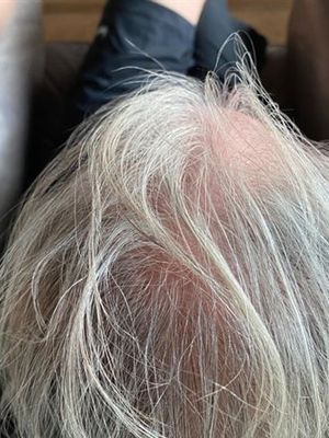 Customer-uploaded image. Click to see more details. The image represents: Person with gray hair lying back in what appears to be a salon chair