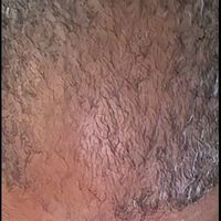 Customer-uploaded image. Click to see more details. The image represents: Close-up view of textured skin surface