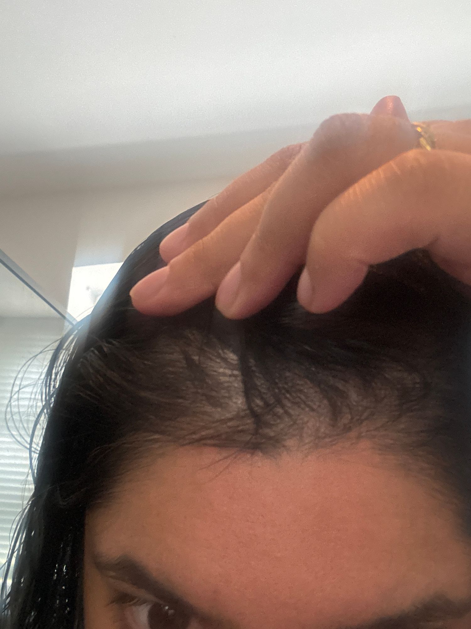 ghk-cu reddit hair ghk cu microneedling Restoracell with Copper Peptides, a Great Partner for Vitali Skincare Copper Peptide Microneedling in Miami DENSITY + REPAIR | Hair