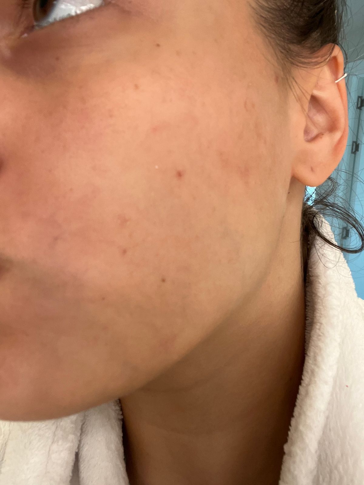 Customer photo