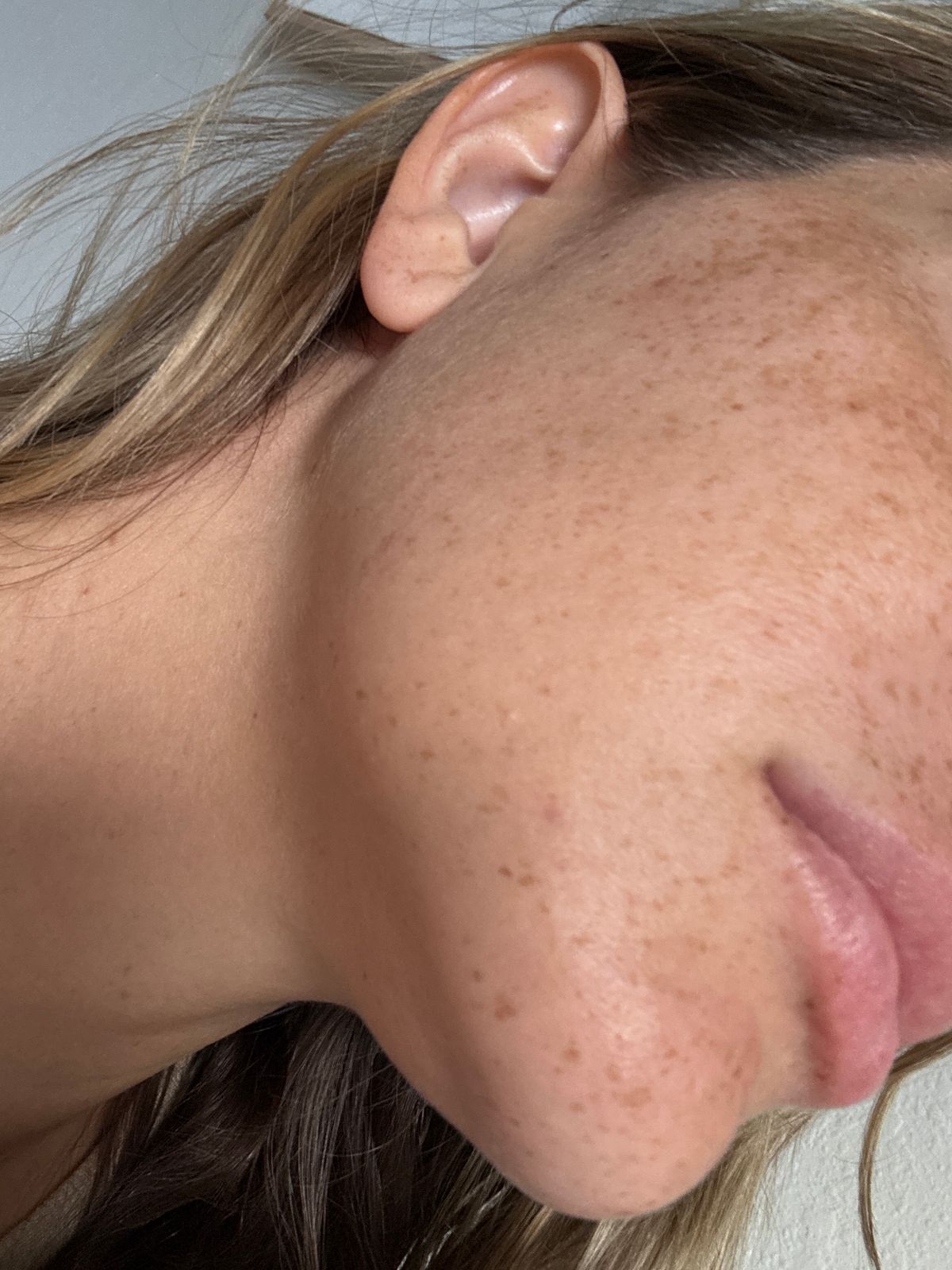 Close-up profile view of a person's face showing freckled skin and blonde hair