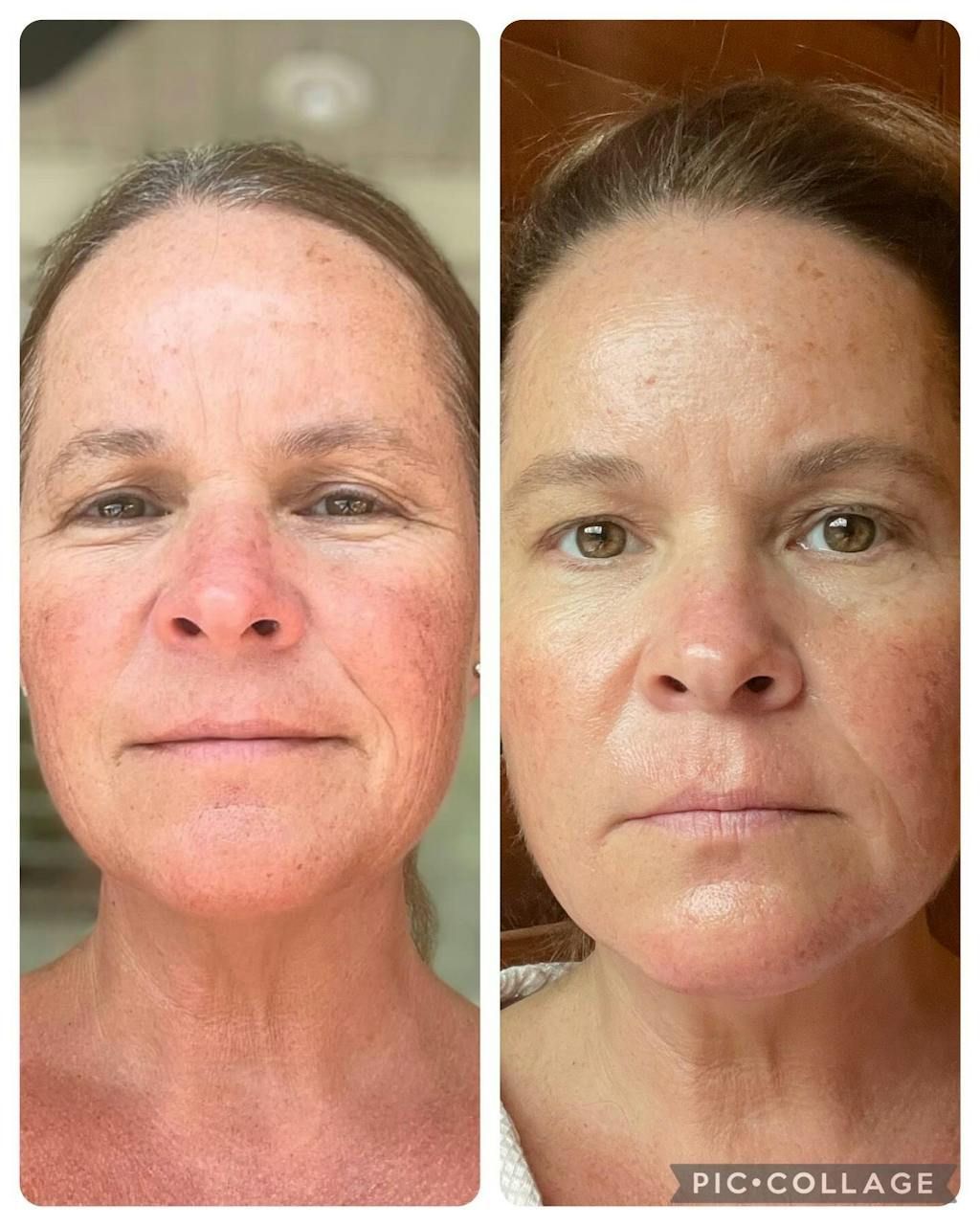 ghk cu nasal spray before and after AGELYTIX NAD NMN GHK CU NASAL SPRAY — CURETONIX